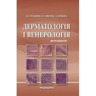 Дерматологія і венерологія. 2-е видання