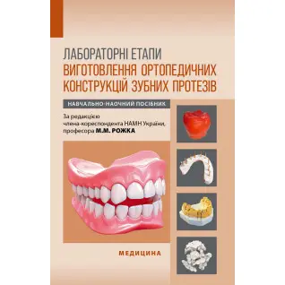Лабораторні етапи виготовлення ортопедичних конструкцій зубних протезів