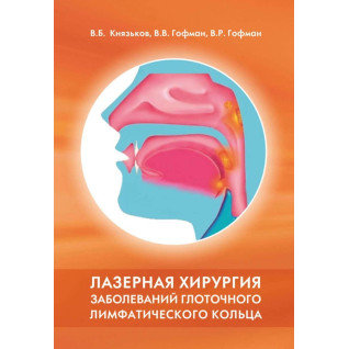 Лазерна хірургія захворювань глотичного лімфатичного кільця. Лазерна хірургія захворювань глотичного лімфатичного кільця.