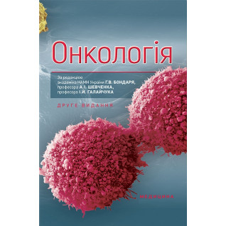 Онкологія. 2-е видання Онкологія. 2-е видання