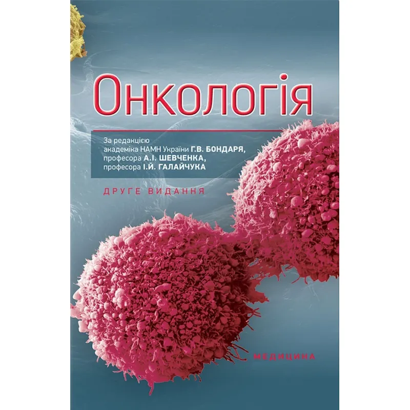 Онкологія. 2-е видання