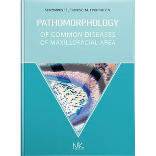 Pathomorphology of Сommon Diseases of Maxillofacial Area. Starchenko I. I., Filenko B. M., Cherniak V. V. Pathomorphology of Сommon Diseases of Maxillofacial Area. Starchenko I. I., Filenko B. M., Cherniak V. V.