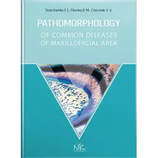 Pathomorphology of Сommon Diseases of Maxillofacial Area. Starchenko I. I., Filenko B. M., Cherniak V. V.